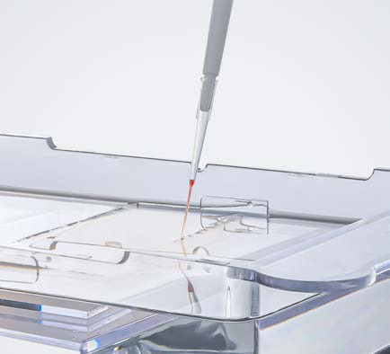Gel loading tip loading a sample into a gel well (photo)